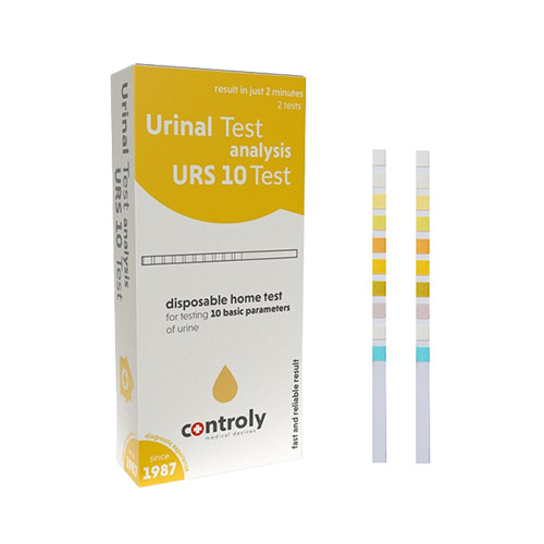 Test delle urine, 2 test
